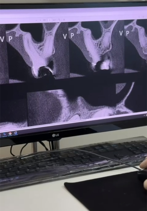 Tomografia na Endodontia - Imagem 1