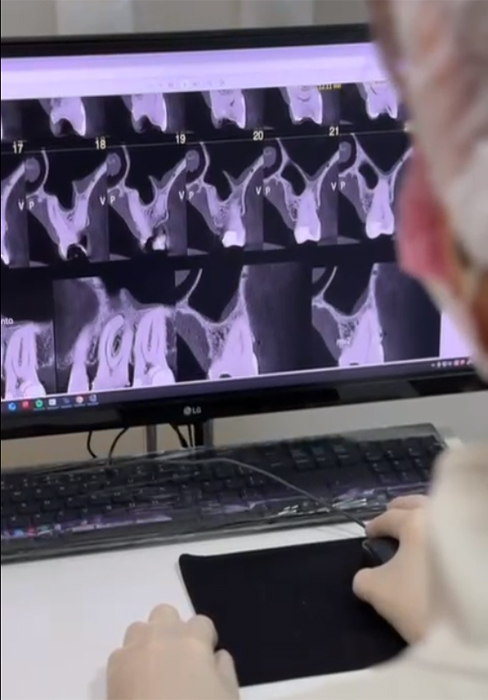 Tomografia na Endodontia - Imagem 3